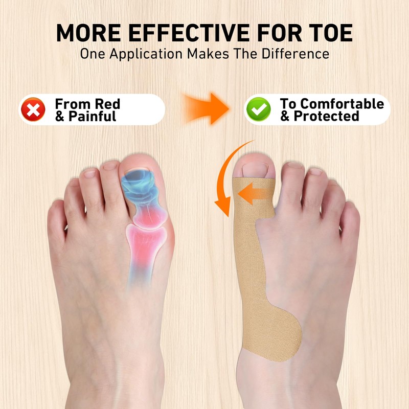 KTQUICK PreCut Latex-Free Kinesiology Tape for Bunions&Hallux Valgus,40 PCS