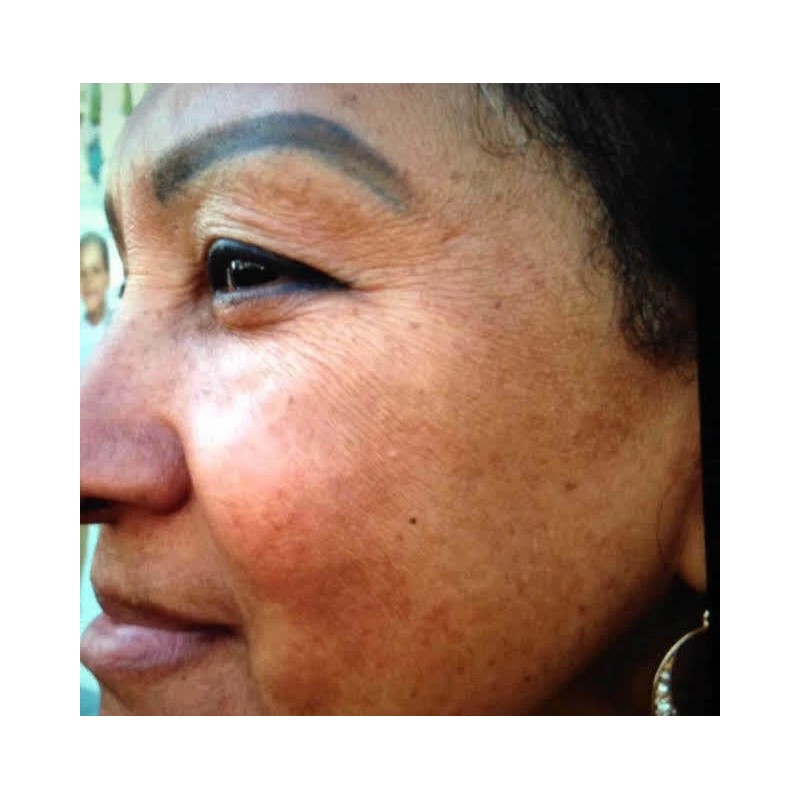 Crema aclaradora White Fade Super Skin, Para Piel Triguena O