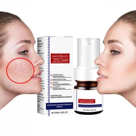 USA Whiting And Freckle Removing Serum Cream Dark Spot Removing Freckle Essence