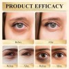 Aa. Corrector De Ojos Fps 41, Corrector De Ojeras, Lkjh