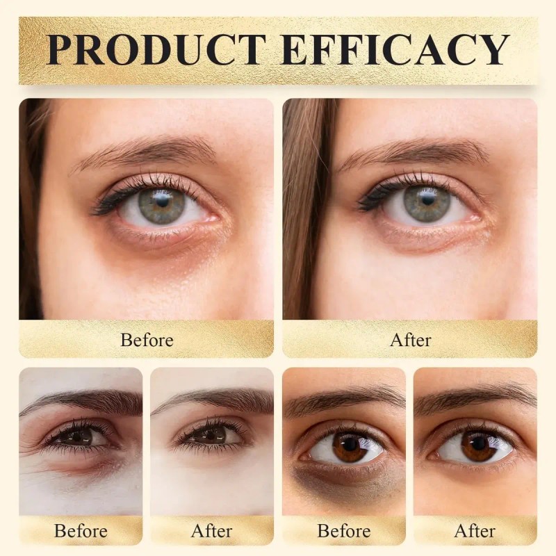Aa. Corrector De Ojos Fps 41, Corrector De Ojeras, Lkjh