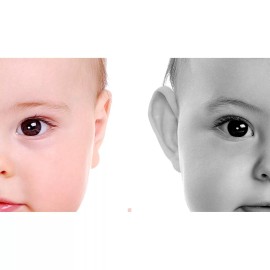 Otostick NEW OTOSTICK Cosmetic Baby  Ear Correctors Set of 8  Ear Correctors (NIB)