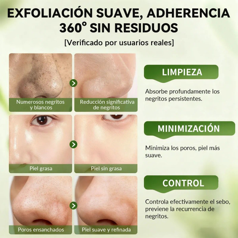 Lanbena Mascarilla Facial Puntos Negros30g Pzs Papel Todo Tipo Piel