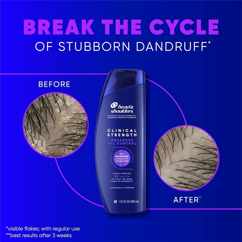 Head & Shoulders Clinical Strength Anti-Dandruff Shampoo – Advanced Oil