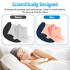 Chic Derma Comfortable Sleep Mouth Guard – Custom Fit Nighttime