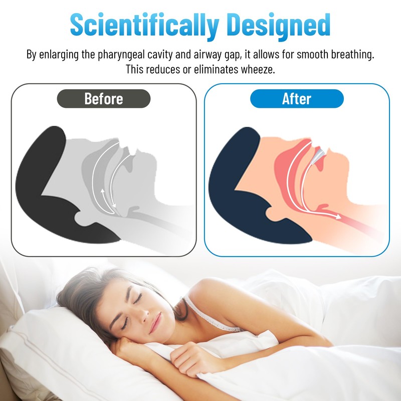 Chic Derma Comfortable Sleep Mouth Guard – Custom Fit Nighttime