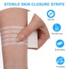 Wound Closure Strips, Pack of 50, Staple Plaster Strips, Skin