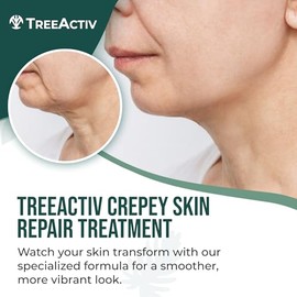 Treeactiv Crepey Skin Repair Treatment Anti Aging Wrinkle Organic Ingredients For Face Neck Chest Legs Arms Hyaluronic Acid Alpha Hydroxy Fruit Acids