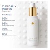 Dove Suero Dirigido Multiusos Estrías Targeted Serum