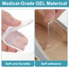 Shimmeroo 5 Pairs Medial & Lateral Heel Wedge Silicone Insoles