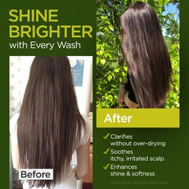 Tea Tree Rosemary Shampoo and Conditioner Set with Castor Oil for All Hair Types - Effective Cleanse and Supports Scalp Health for Women & Men Paraben & Sulfate Free (16 Oz Each)