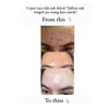 Tabita Original Tabita Skincare Skin Anti-Aging Acne Scar Stretch Mark