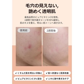 Klairs Fresh Juice Vitamin Drops, 1.2 fl oz (35 ml), Korean Cosmetics, Skin Essence, Vitamin C Serum, Home Care, Pores, Dry Skin, Moisture, Skin Care, Hypoallergenic, Cosmetics Gift