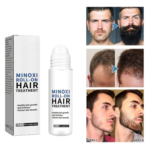 Mz Hace Crecer La Barba Y El Cabello, Original, 18