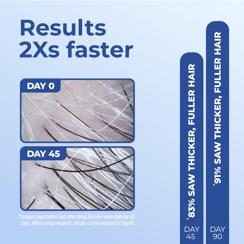 Bosley Revive+ Densifying Serum for Men