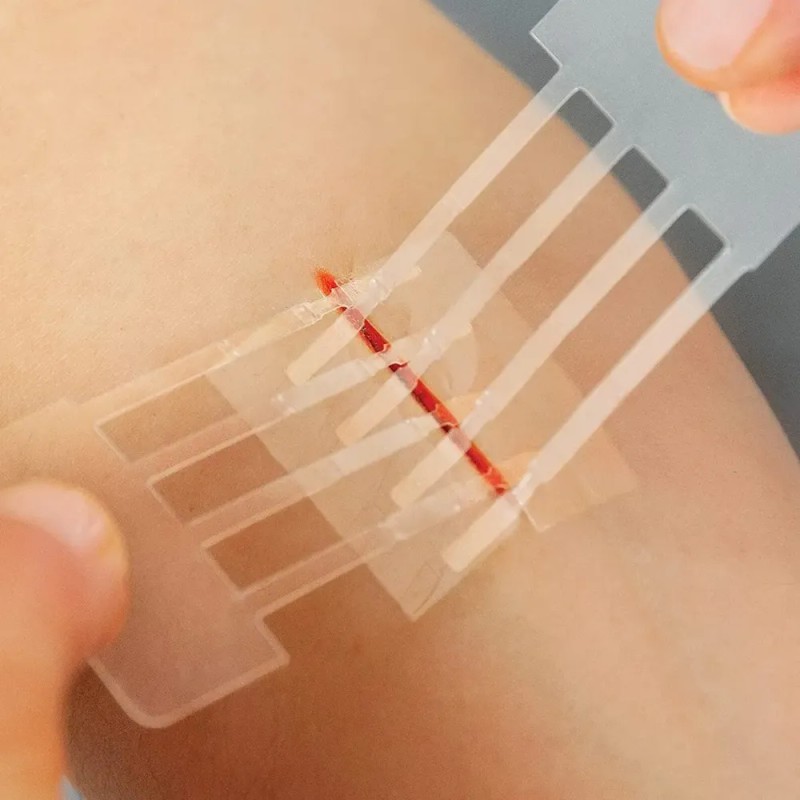Curita Cierre De Laceraciones Reparacion Heridas Sin Costura