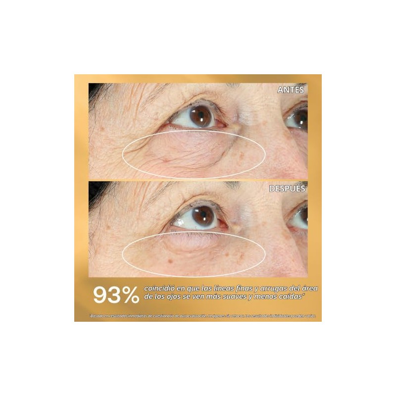 StriVectin, Hyperlift Eye™ Instant Eye Fix