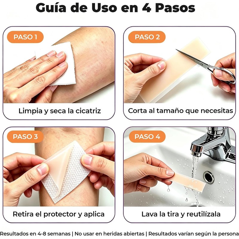 Parches de Silicona para Cicatrices 1.5M - Reducción Visible y