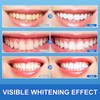 9D Teeth Whitening Strips 14 Treatments, Enamel Safe, Whitening Teeth