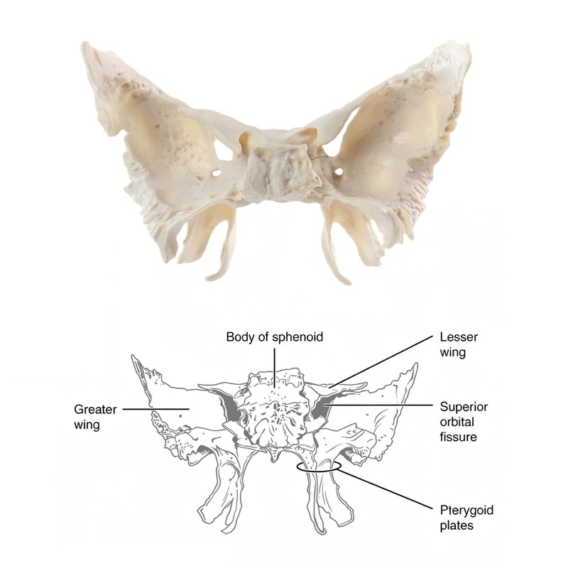 Benilev Human Sphenoid Anatomical Model, Life Size, Presenting Complete Cracks,
