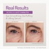 Skin Doctors Instant Eye Lift 10mL