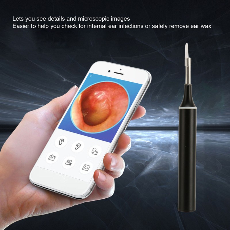 Earwax Removal Kit Intelligent Visible Support APP Ear Cleaner with