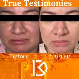 Limpiador Facial Exfoliante con Ácido Glicólico al 10% y Niacinamida B3