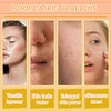 Set Cuidado Facial Kit Limpiador Tónico Contorno Ojos Sérum Jabón