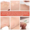 KORMESIC Original Acne Patch - Hydrocolloid Acne Pimple Patch for