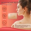 Silicone Scar Sheets (1.6”x 60” Roll-1.5M), Medical Grade Silicone Scar
