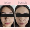 Serum 4 En 1 - Vitamina C + Ácido Hialurónico