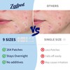Large Pimple Patches for Face，9 Sizes XL Acne Patches，Big Hydrocolloid