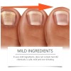 Tratamiento De Uñas De Los Pies Para Mujeres, Extractos De