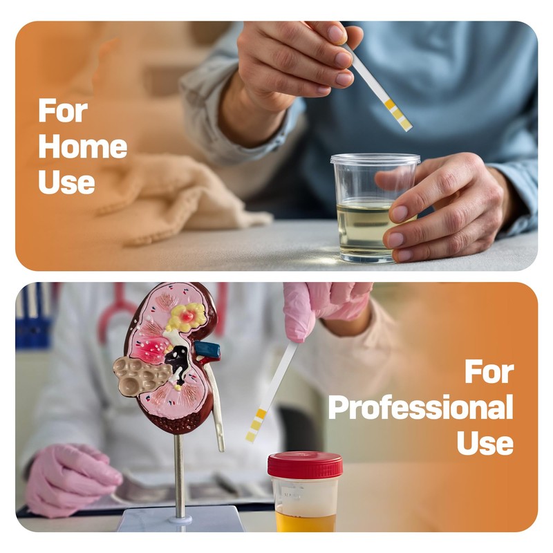 One Step: 5 x Kidney Function Test Strips, Creatinine, Protein