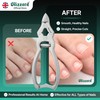 Blizzard Toe Nail Clippers for Thick Nails - Podiatrist Nail