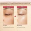 Celdyque Pdrn 25% Concentrate Skincare Booster 30ml