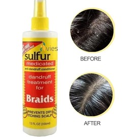 Sulfur Medicated Anti-Dandruff Conditioner for Braids, 356 ml