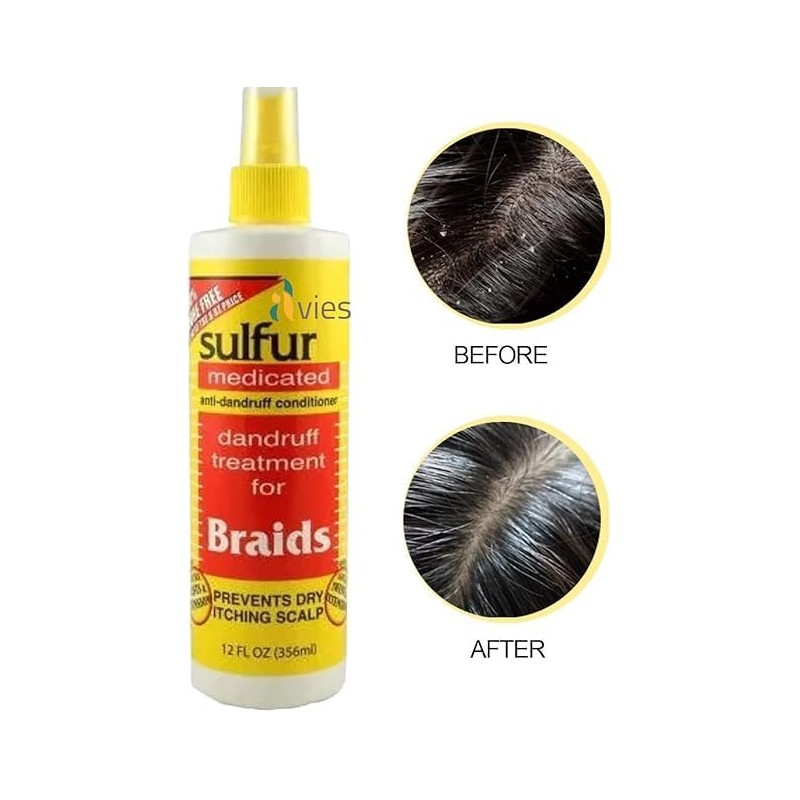 Sulfur Medicated Anti-Dandruff Conditioner for Braids, 356 ml