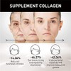Eelhoe Eternity Vitamin C Serum Dark Spot Corrector, Esencia de