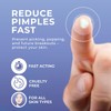 PatchRx Pimple Patches Salicylic Acid (120 Pack), Salicylic Acid Pimple