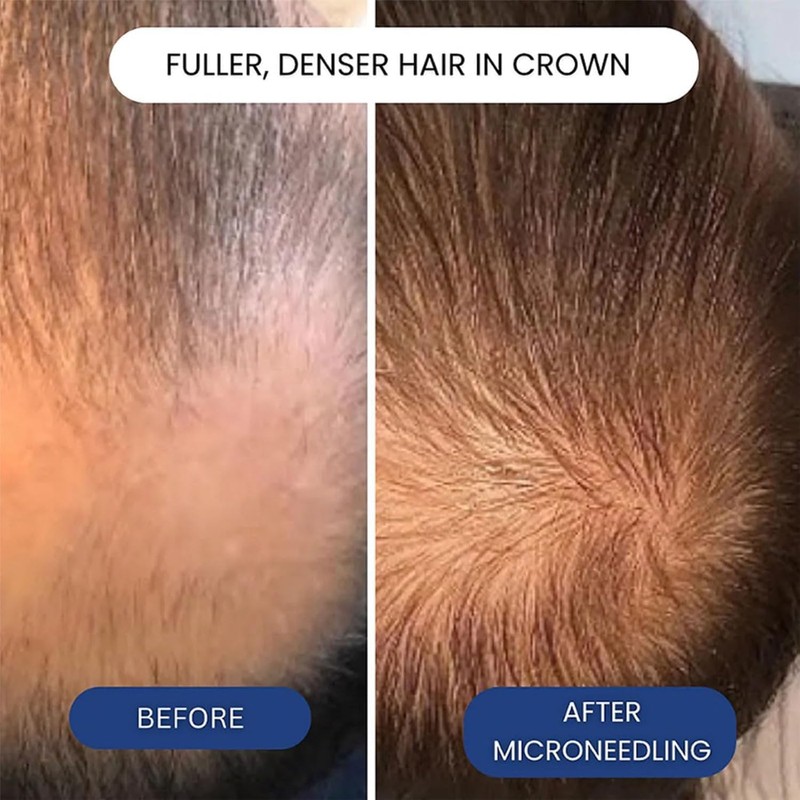 Copper Peptide Hair Growth Serum for Plumper & Denser Hair