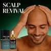 Crema Hidratante Hialurónica Para Cuero Cabelludo Bald Care