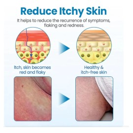 Crema Para La Piel Masculina Adecuada Para La Picazón En Áre