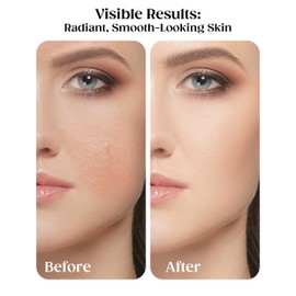 Kaplan MD Diamond Contour Broad Spectrum SPF 30 - Complete Complexion Treatment, Hydrating Sheer Coverage, UVA/UVB & Blue Light Protection, Fragrance-Free, Deep Tinted Sunscreen for Face