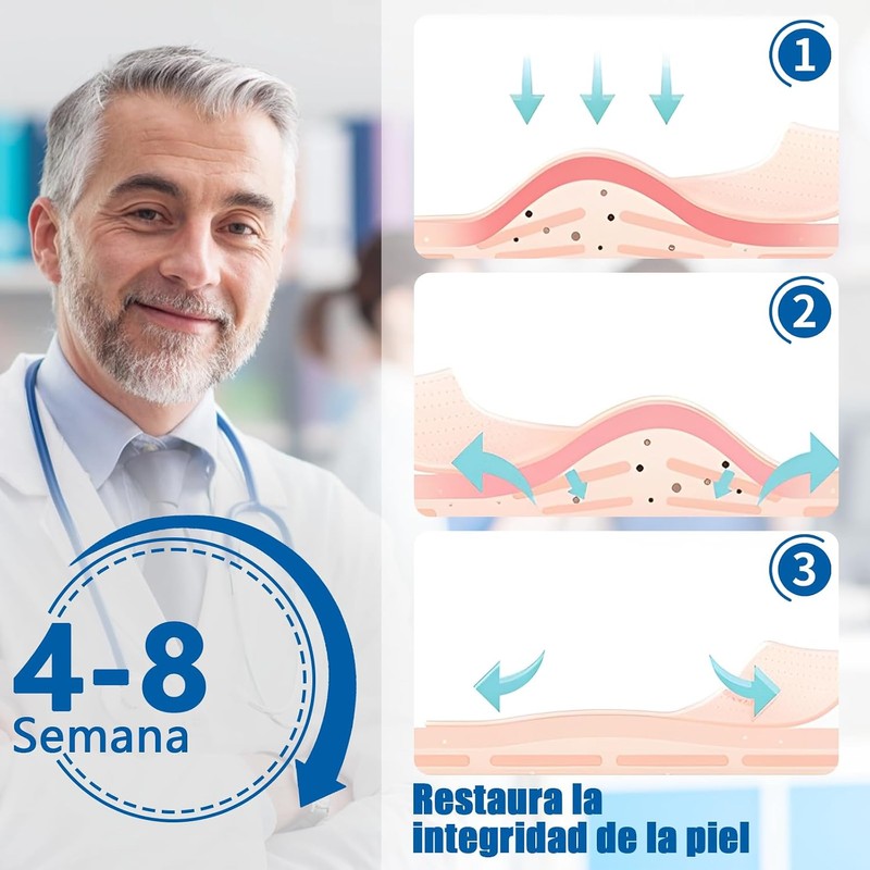 parches de silicona para cicatrices,cinta de silicona para cicatrices, elimina