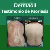 Pomada Natural Para Psoriasis: Hidratación Profunda.
