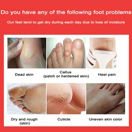 MKNZOME 4 Pairs Foot Peel Mask, Repair Cracked Heels & Remove Dry Dead Skin for Soft Baby Foot Effect, Callus Remover, Foot Exfoliating Socks for Hard Skin, Foot Treatment for Men and Women - Peach