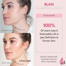 Lip Plumper Device | Non-Invasive Lip Plumping Device, Pain-Free | 60-Second Daily Exercise for Fuller Lips, Defined Jawline & Firmer Skin, MADE IN USA (Lavender)