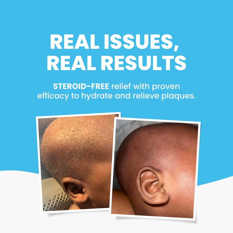 Grahams Natural Kids Eczema Body and Bath Oil 100 ml,