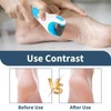 9 Pcs Pedi Replacement Rollers for Scholl, Refills for Scholl